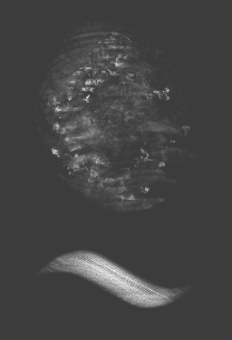 Procedural